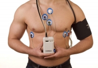 HOLTER EKG